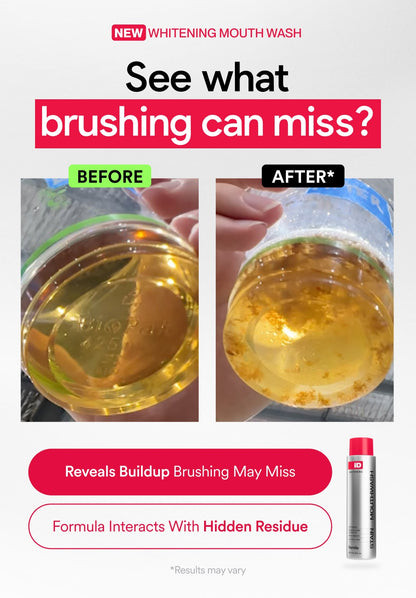 Whitening Mouthwash for ID Stain Removal – Fresh Breath & Brighter Smile