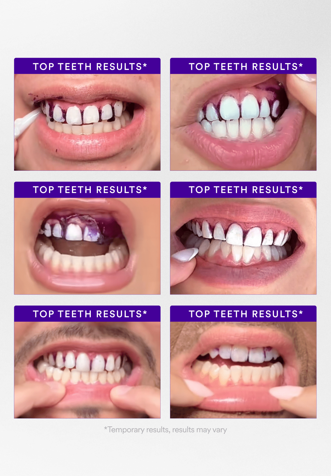 Teeth Whitening Strips with Color Correction – Instant Brightening & Stain Removal